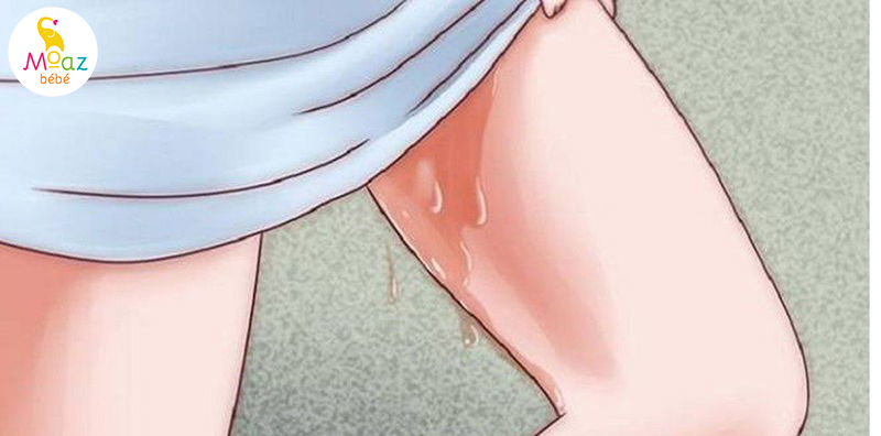 Biểu hiện bất thường của rỉ ối