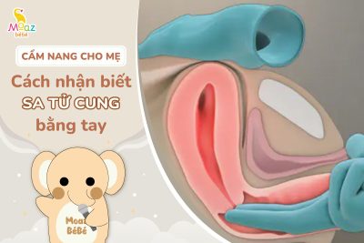 Cách nhận biết sa tử cung bằng tay