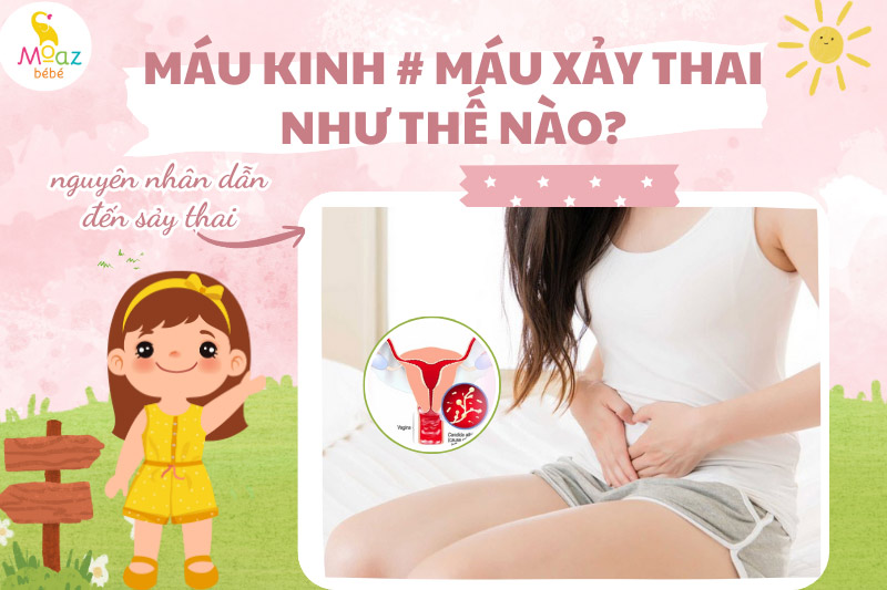 Nguyên nhân dẫn đến máu sảy thai