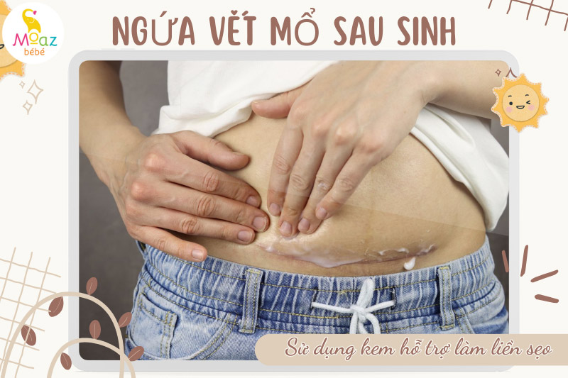 cách giảm ngứa vết mổ sau sinh