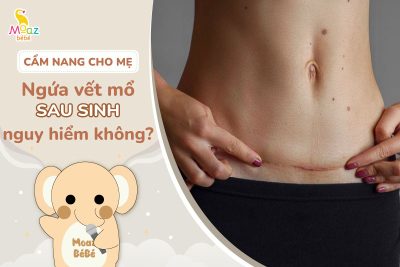 ngứa vết mổ sau sinh có nguy hiểm không