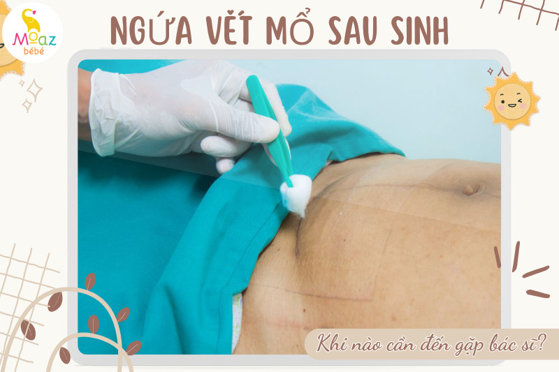 ngứa vết mổ sau sinh khi nào cần đến bác sĩ