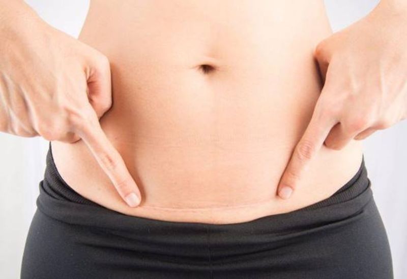 vết mổ sau sinh bao lâu thì lành