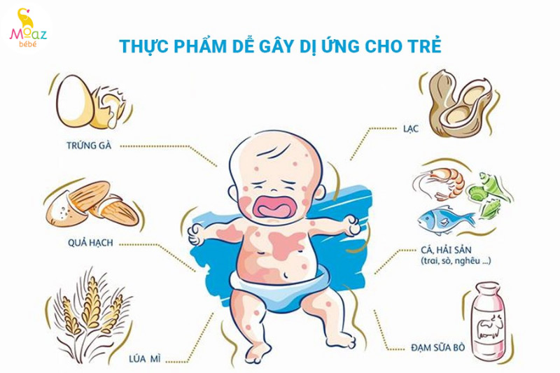 Không ăn thực phẩm gây dị ứng khi đang cho con bú