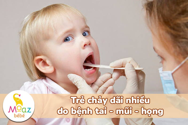 trẻ chảy dãi nhiều do bệnh tai mũi họng