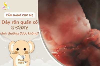 Dây rốn quấn cổ 1 vòng sinh thường được không?