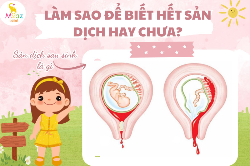 Sản dịch sau sinh là gì?