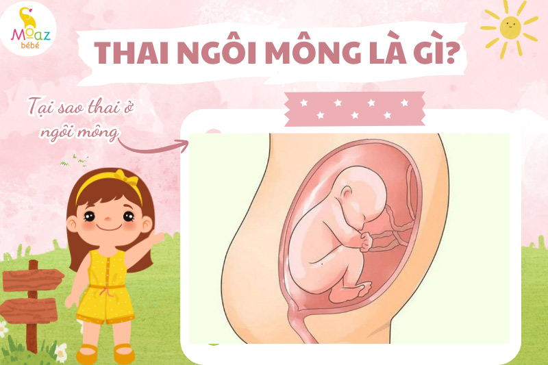 Tại sao thai nhi ở ngôi mông?