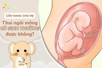 Thai ngôi mông có sinh thường được không?