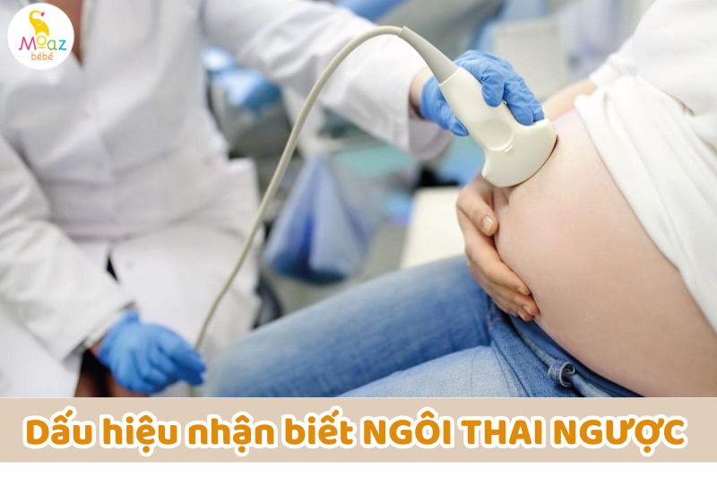 Dấu hiệu nhận biết sớm thai ngôi ngược