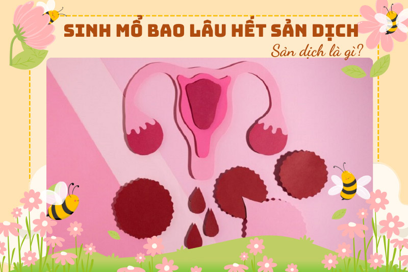 Sản dịch là gì?