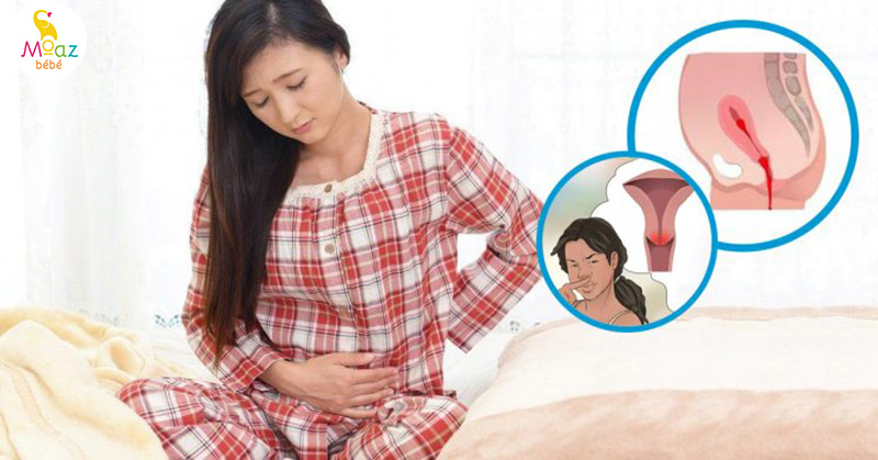 Sinh mổ 1 tháng vẫn ra máu có phải là bất thường?