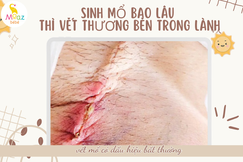 Khi nào vết mổ có dấu hiệu bất thường