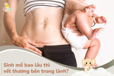 Sinh mổ bao lâu thì vết thương bên trong lành