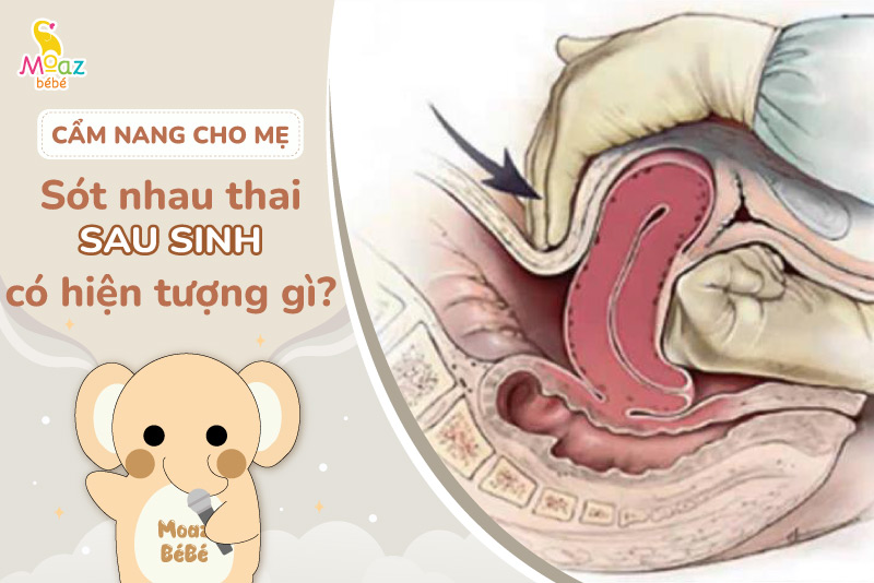 Sót nhau thai có triệu chứng gì?
