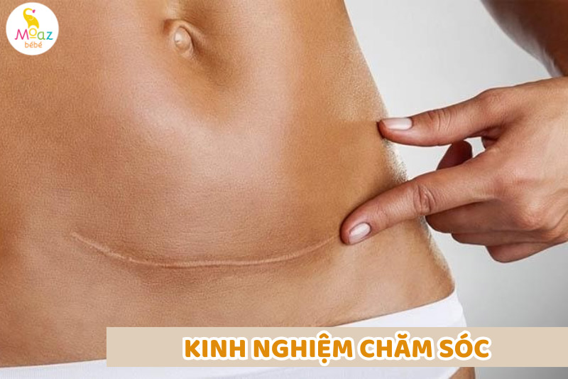 chăm sóc giúp vết khâu tầng sinh môn