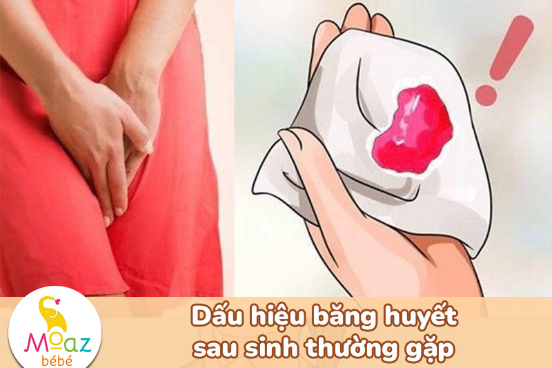 dấu hiệu băng huyết sau sinh thường gặp