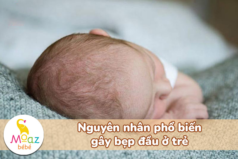 Nguyên nhân phổ biến gây bẹp đầu ở trẻ nhỏ