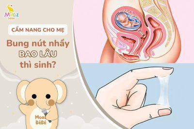 Bung nút nhầy bao lâu là sinh?