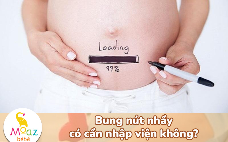 Bung nút nhầy có cần nhập viện không?