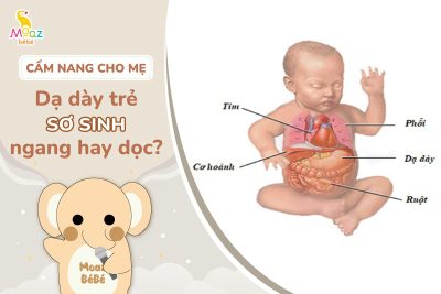 Dạ dày trẻ sơ sinh nằm ngang hay nằm dọc?