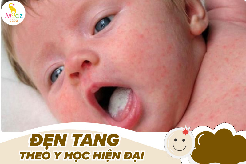 Theo y học hiện đại đẹn tang là gì?