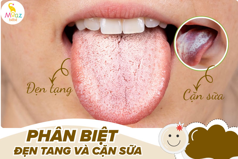 Cách phân biệt đẹn tang và cặn sữa