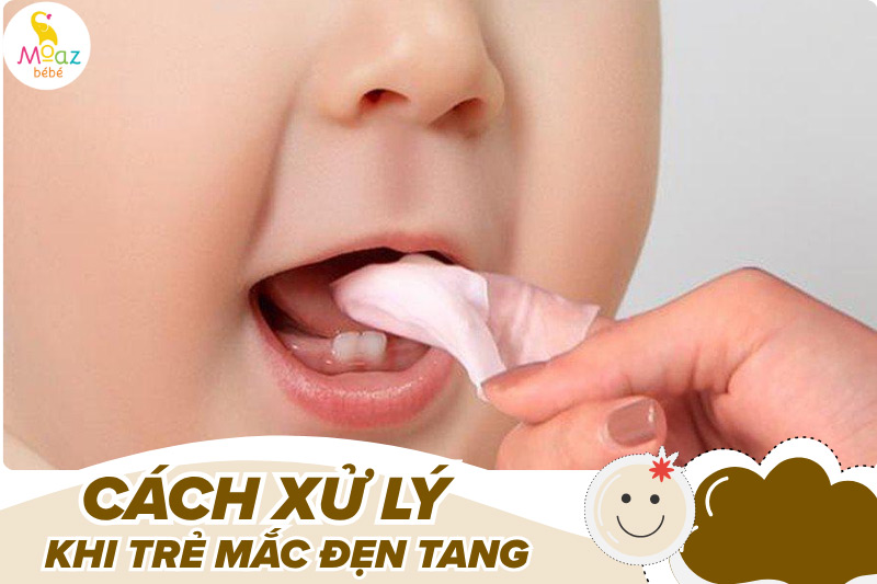 Cách xử lý khi trẻ mắc đẹn tang