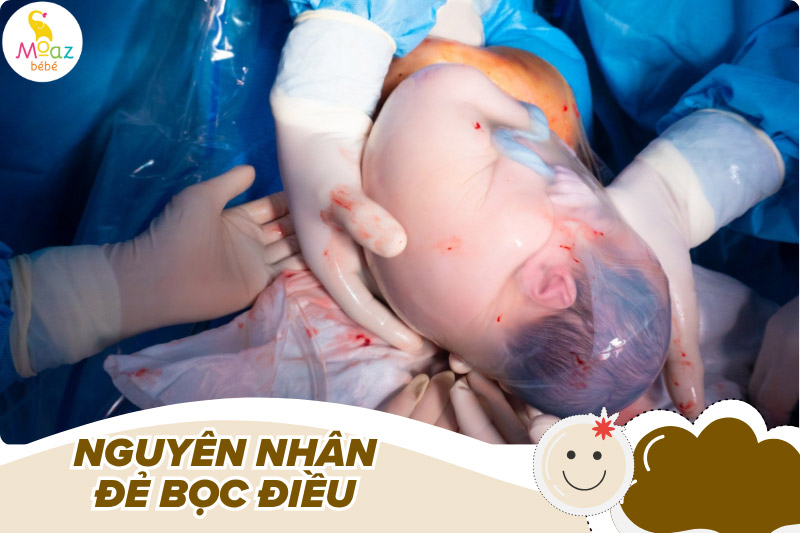 Nguyên nhân xảy ra hiện tượng đẻ bọc điều