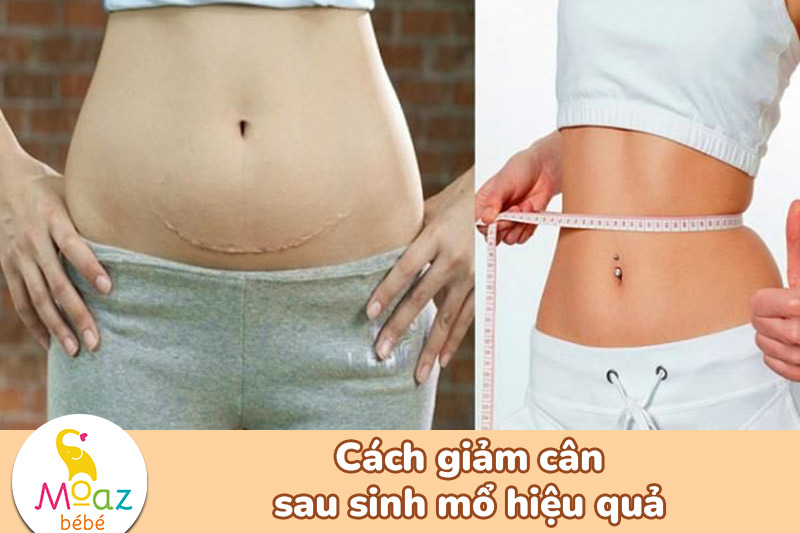 Cách giảm cân sau sinh mổ đúng cách