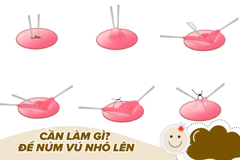 Chị em cần làm gì để núm vú nhô lên?