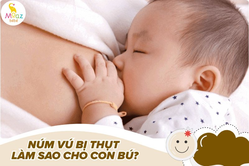 Núm vú bị thụt làm sao cho con bú dễ hơn?
