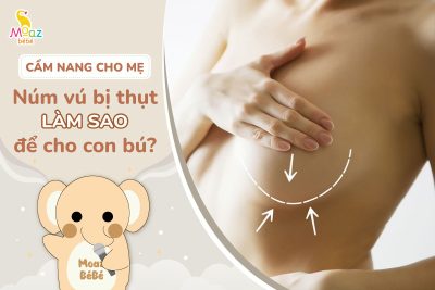 Núm vú bị thụt làm sao cho con bú?