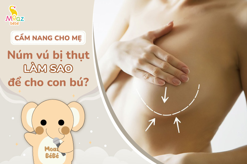 Núm vú bị thụt làm sao cho con bú?