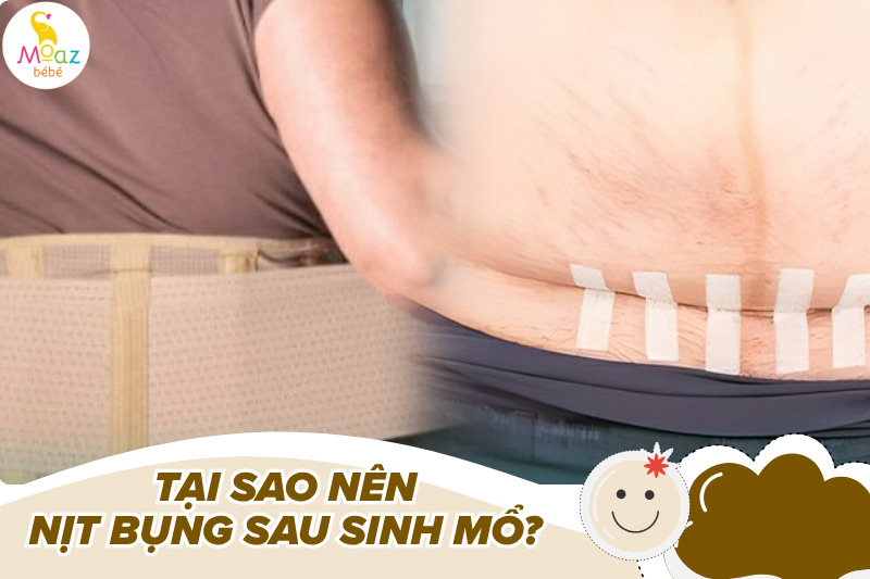 Tại sao nên nịt bụng sau sinh mổ?