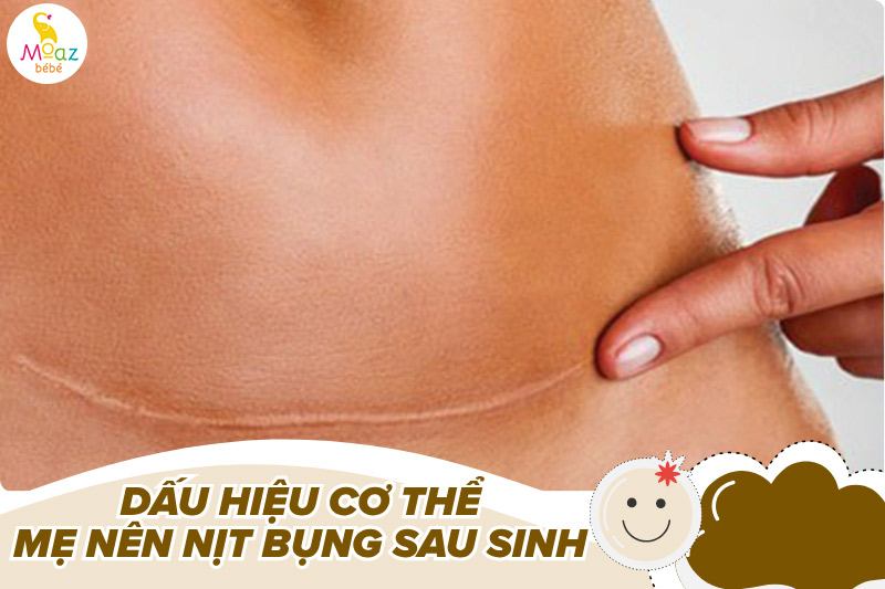 Dấu hiệu cơ thể mẹ nên nịt bụng sau sinh mổ