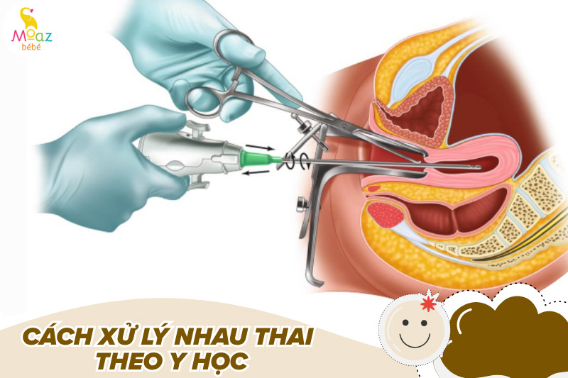 Cách xử lý nhau thai sau khi sinh theo y học