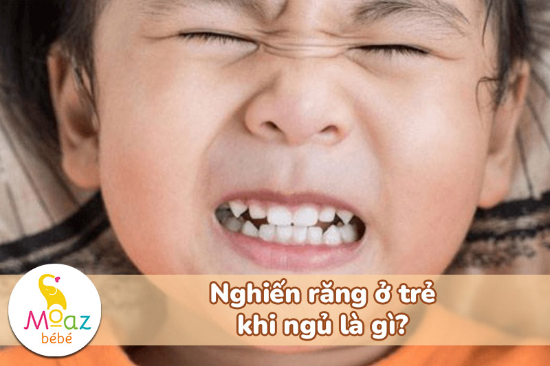 Mẹo chữa nghiến răng ở trẻ em khi ngủ đơn giản mà hiệu quả 4 Nghiến răng ở trẻ em khi ngủ là gì?