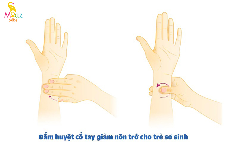 Mẹo bấm huyệt cổ tay để giảm nôn trớ ở trẻ sơ sinh