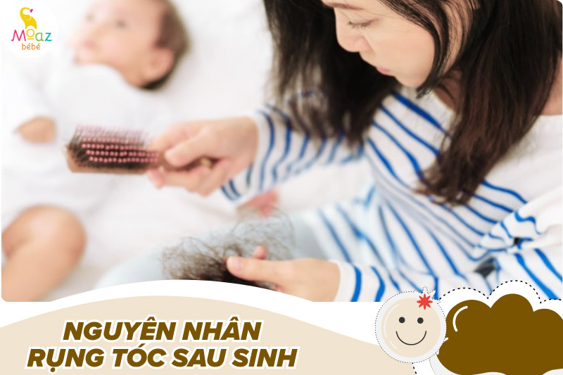 Rụng tóc sau sinh bao lâu thì hết? Cách khắc phục hiệu quả 1 Nguyên nhân rụng tóc sau sinh là gì?
