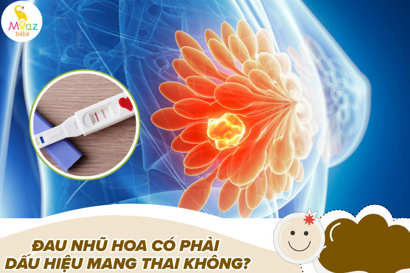 Đau 2 đầu nhũ hoa là hiện tượng gì? Có phải mang thai không? 3 Đau nhũ hoa có phải dấu hiệu mang thai không?