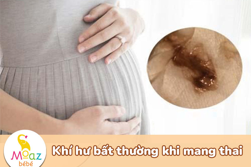 Dịch nhầy khi mang thai tuần đầu màu gì? cách nhận biết mang thai qua khí hư 4 khí hư bất thường khi mang thai