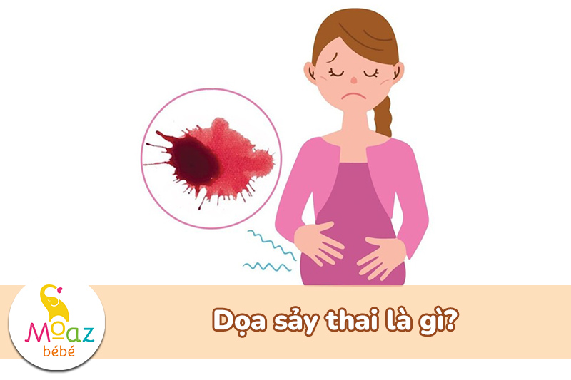 Dọa sảy thai ra máu bao lâu? Cách nhận biết máu dọa sảy thai 1 doạ sảy thai là gì
