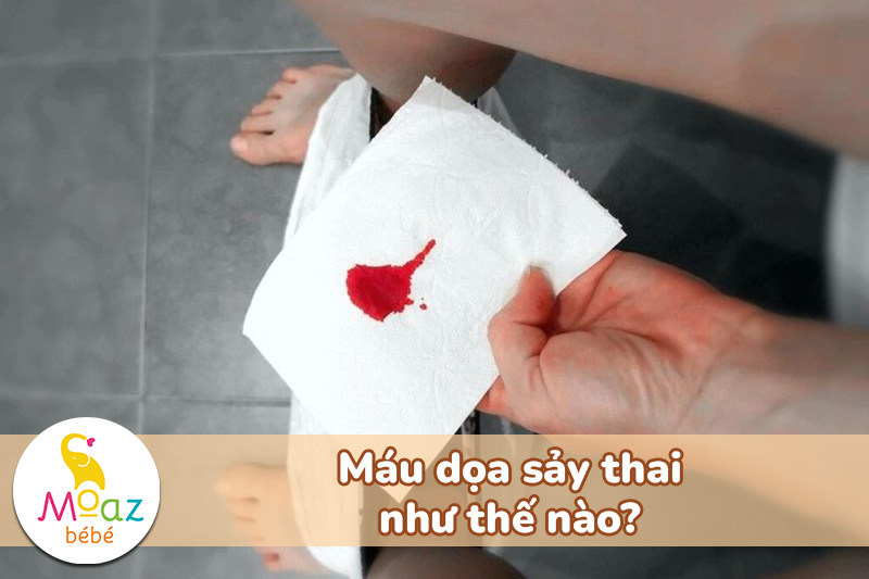 Dọa sảy thai ra máu bao lâu? Cách nhận biết máu dọa sảy thai 3 Máu dọa sảy thai như thế nào?