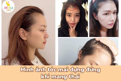 hình ảnh tóc mai dựng đứng khi mang thai