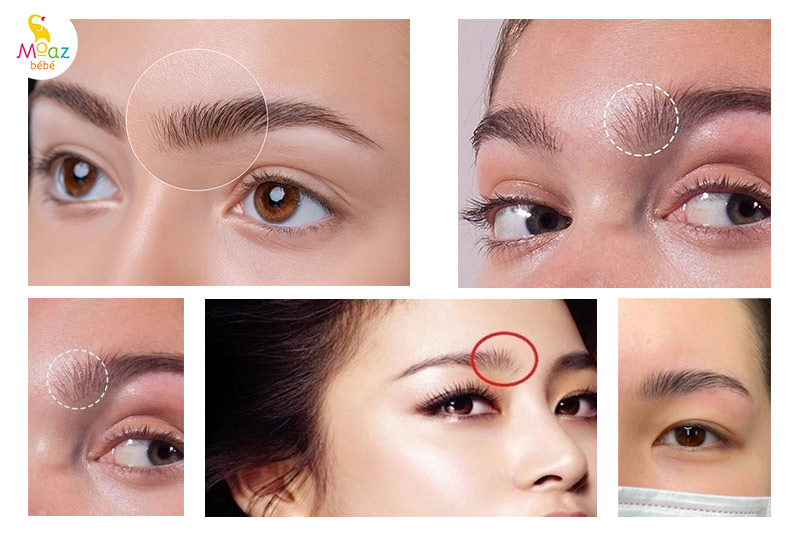 Hình ảnh lông mày dựng khi mang thai.