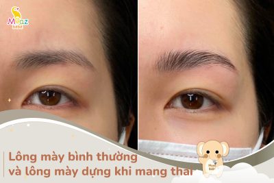 Mẹo nhận biết lông mày bình thường và lông mày khi mang thai 27 Lông mày bình thường và lông mày khi mang thai