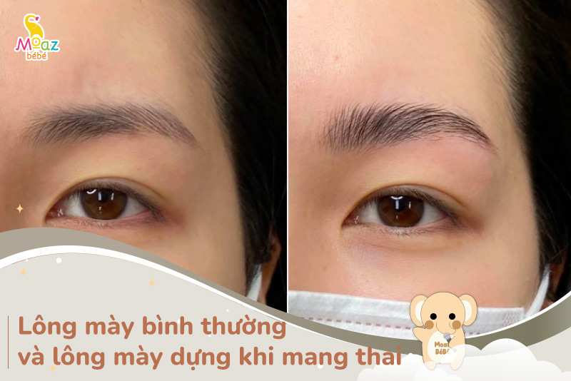 Lông mày bình thường và lông mày khi mang thai