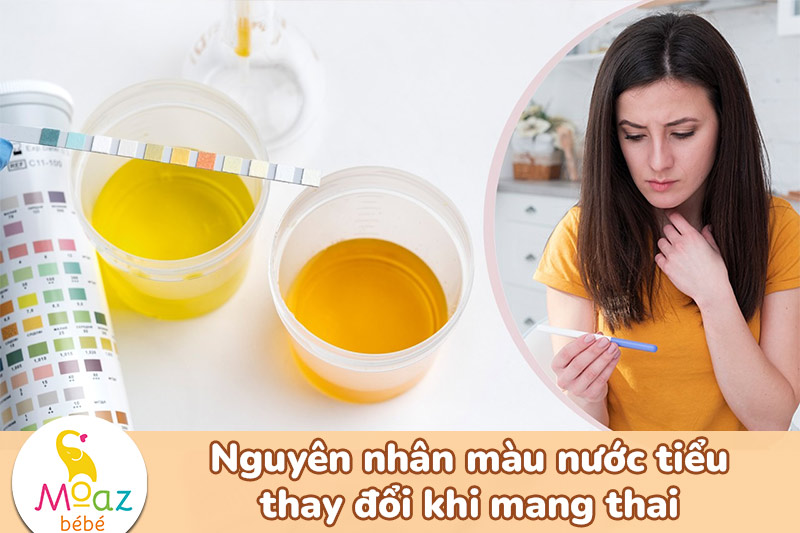 Nguyên nhân màu nước tiểu thay đổi khi mang thai