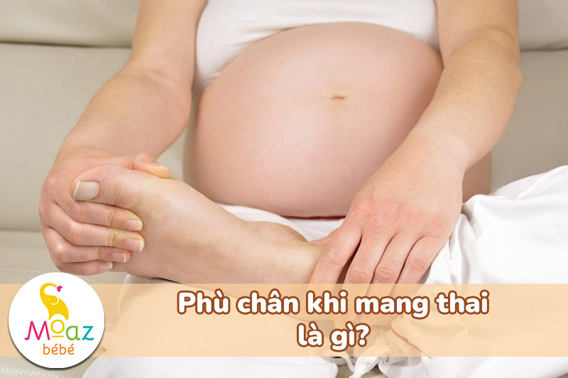 Phù chân khi mang thai là gì?